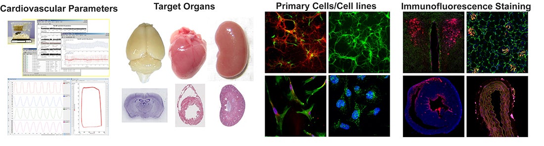 Cardiovascular Parameters, Target Organs, Primary Cells and Immunoflorescence Staining